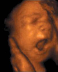 yawning12 weeks.jpg (4855 bytes)